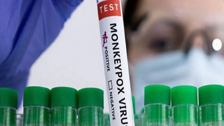 Monkeypox Latest News: दिल्ली में मंकीपॉक्स का पांचवां मामला आया सामने, अफ्रीकी युवती पायी गयी संक्रमित