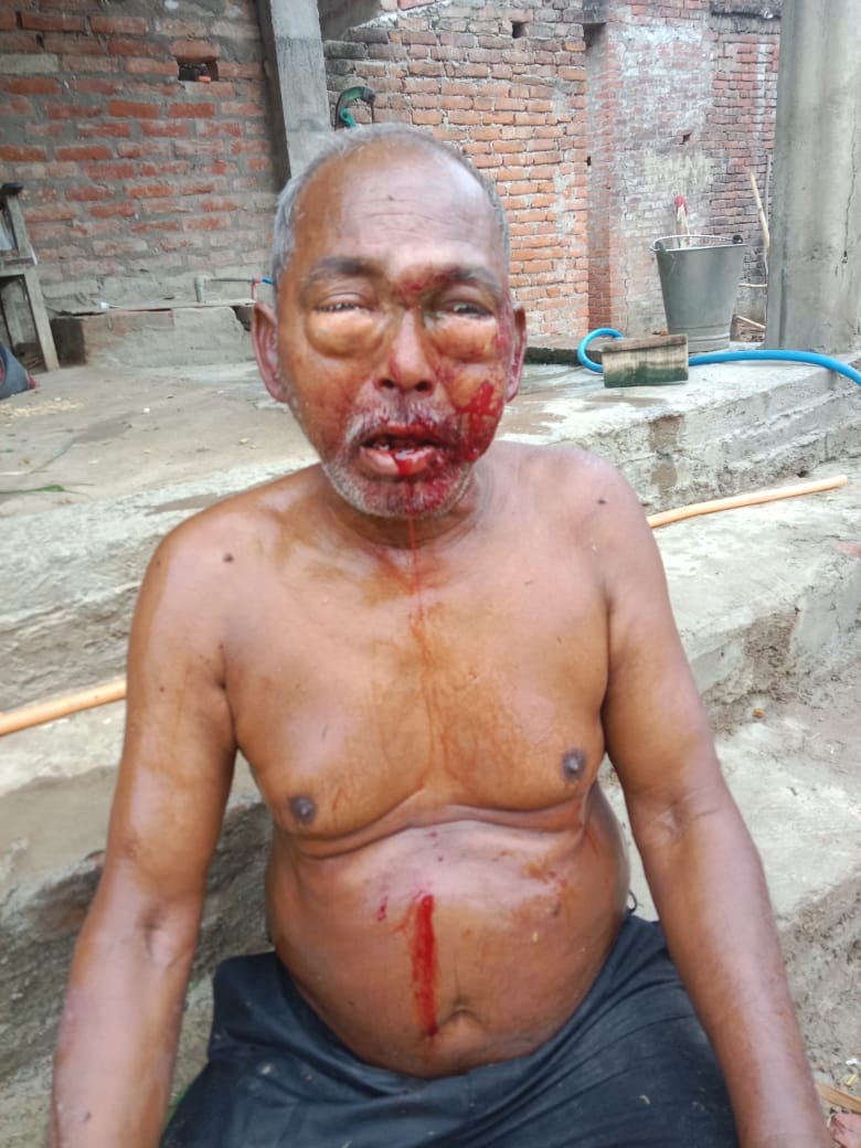 The bullies beat up the old man and injured him. Refer, case registered against two people.