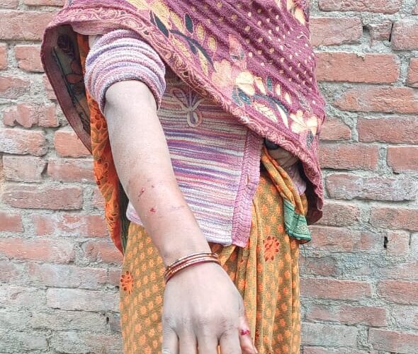 पागल सियार के हमले से 2 महिलाएं जख्मी